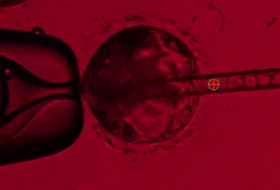 Scientists attempting to harvest human organs in pigs create human-pig embryo